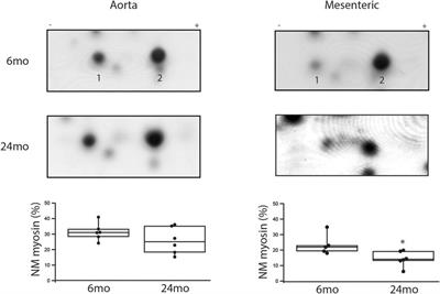 Aging related decreases in NM myosin expression and contractility in a resistance vessel